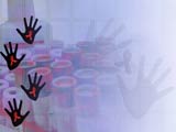 PowerPoint Templates - AIDS