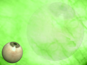 Fundus (Eye) Title Content PowerPoint Template