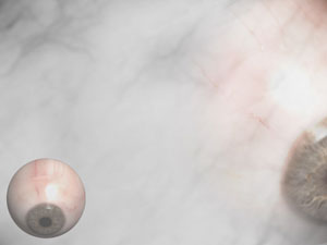 Fundus (Eye) Title Content PowerPoint Template