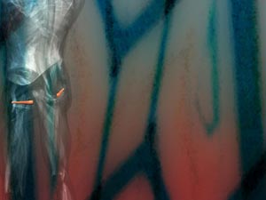 Superior Gemellus Muscle Title Content PowerPoint Template