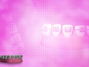 Dental Braces Title Content PowerPoint Template