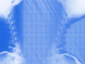 Neck X-ray Title Content PowerPoint Template