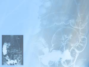 Intestine Title Content PowerPoint Template