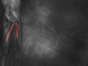 Adductor Longus Muscle Title Content PowerPoint Template