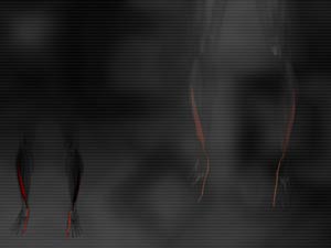 Flexor Hallucis Longus Muscle Title Content PowerPoint Template