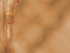 Inferior Gemellus Muscle Title Content PowerPoint Template