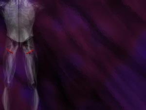 Inferior Gemellus Muscle Title Content PowerPoint Template