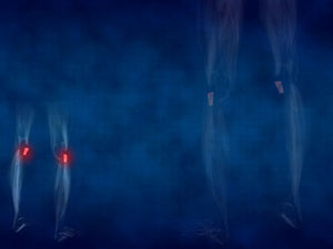 Patellar Ligament Title Content PowerPoint Template